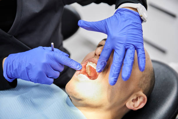 Best Emergency Gum Treatment in Woodlake, VA