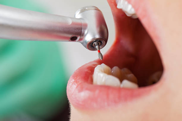 Best Weekend Emergency Dentist in Woodlake, VA